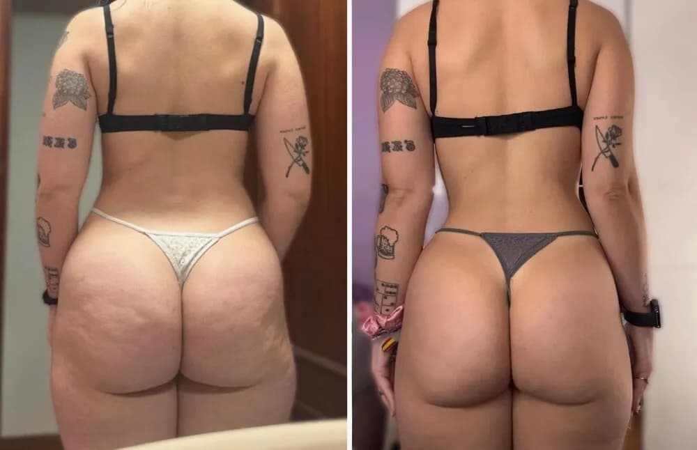 Transformación 3